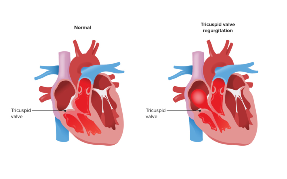 Transesophageal Echocardiogram  Amelia Heart & Vascular Center