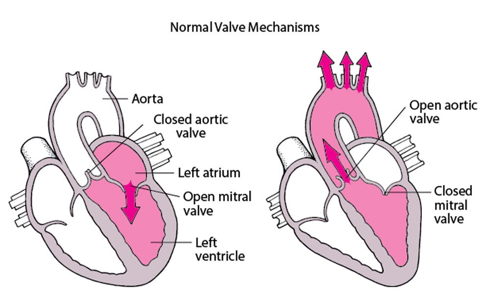 Mitral & Aortic