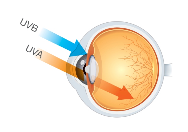 Eye diagram